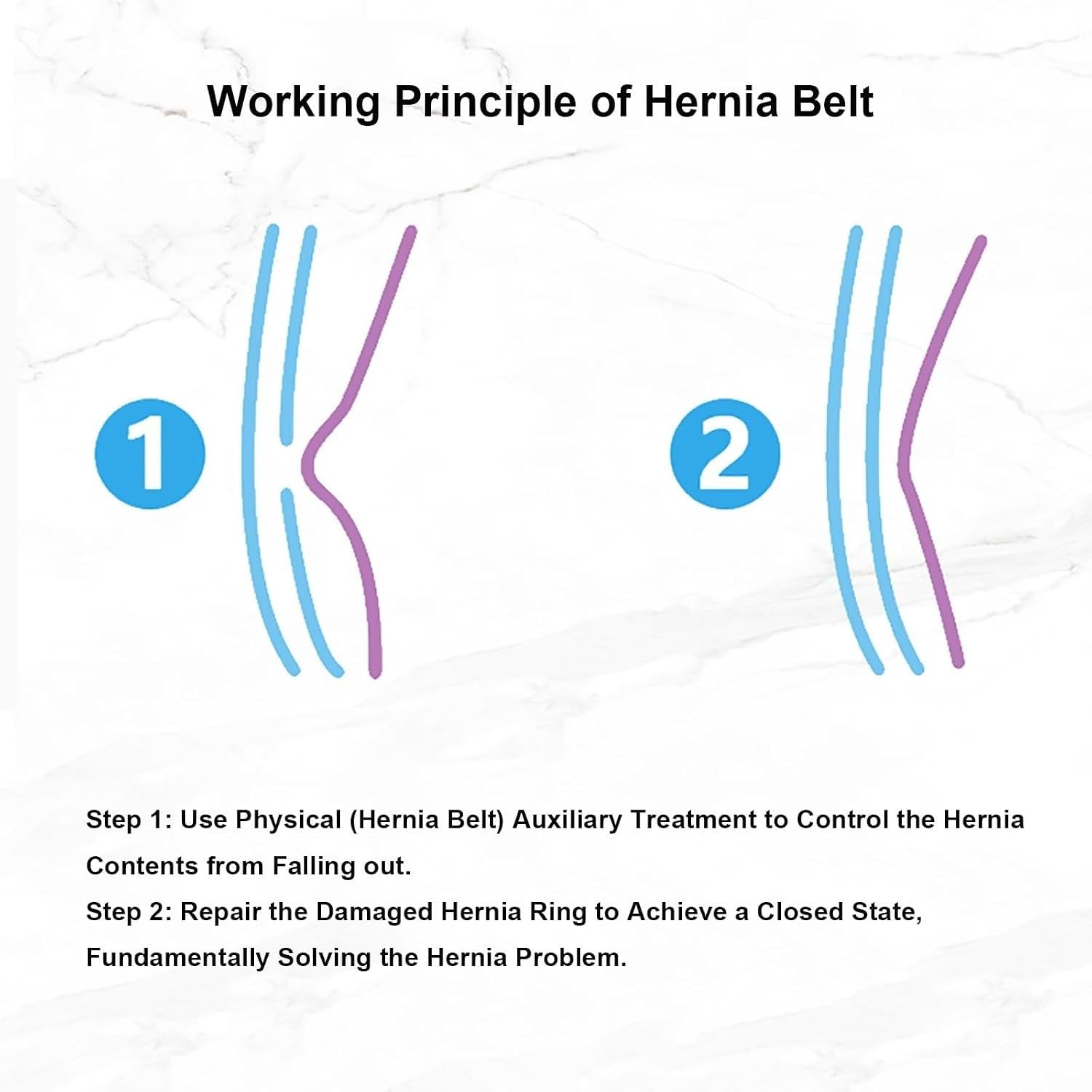 Herniengürtel Für Männer, Leistenbruch Bandage Verstellbar Mit Stützkissen, Leistenbruchgürtel Herren, Bruchband Für Männer, Diskreter Hüftgurt Und Bauchbandage Für Den Täglichen Gebrauch XL