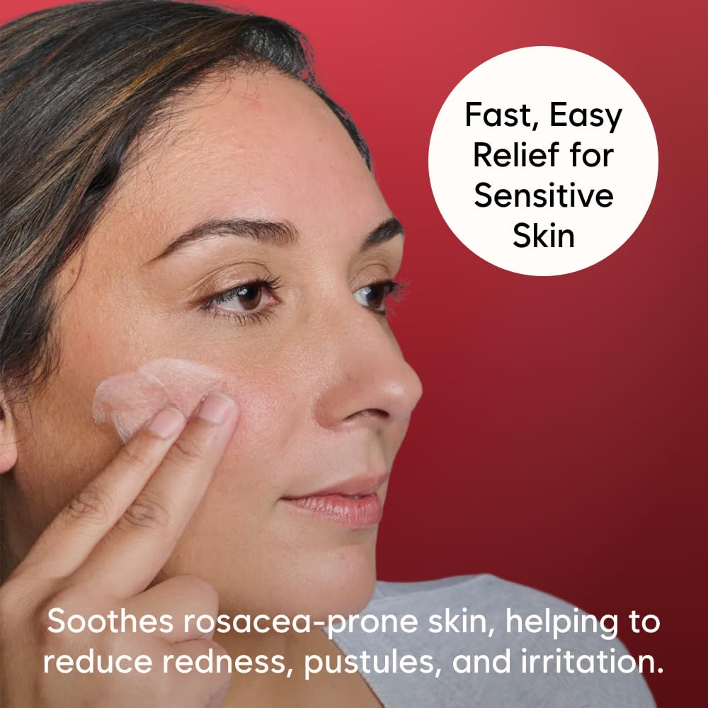 Gladskin ROSACEAR Cream für zu Rosacea neigende & empfindliche Haut (30ml) - Feuchtigkeitsspendende Gesichtscreme, dermatologisch getestet, parfümfrei & hypoallergen