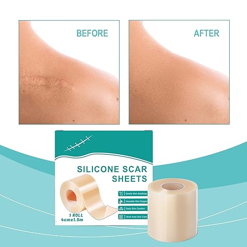 Miniatura 4 de Parche nutritivo suave para el cuidado diario de la piel para mejorar la apariencia de cicatrices y reparar el tejido (adecuado para piel dañada en