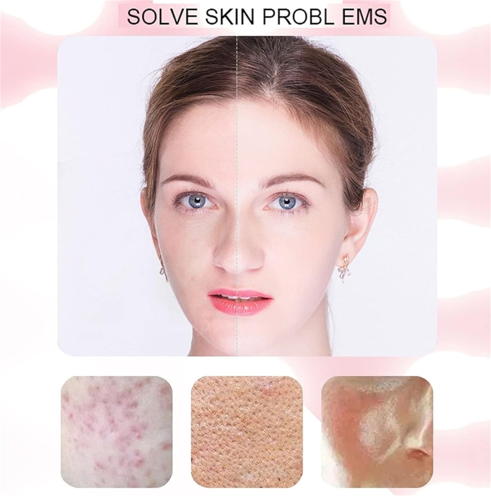 Aparato de belleza facial RF, Aparato de belleza facial de radiofrecuencia y microcorriente, Máquina de rejuvenecimiento de arrugas para reafirmar y tensar la piel