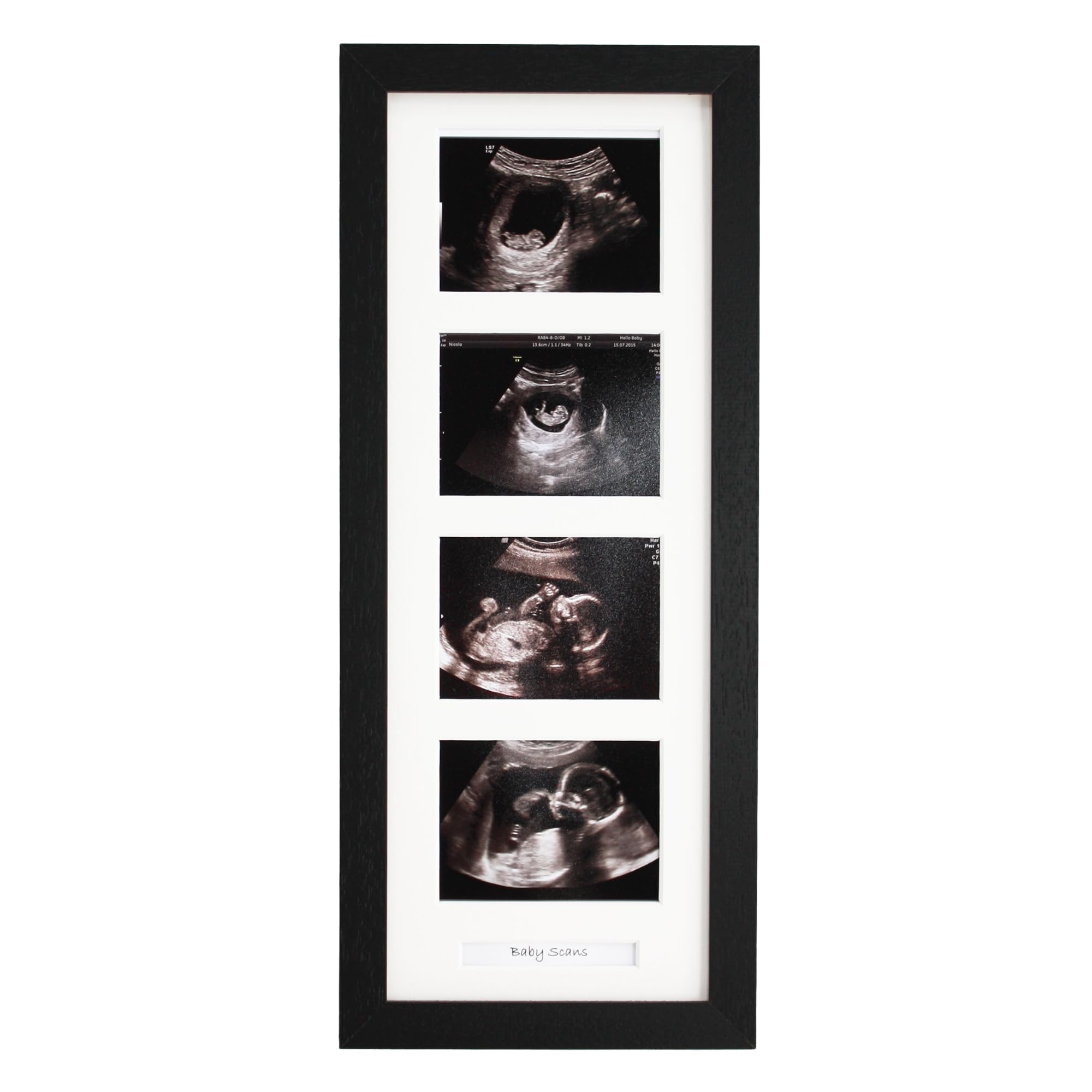 Baby Scan Photo Frame. Optional Personalisation. Multi Aperture Frame to display Four Ultra sound photographs.Portrait. Pregnancy announcment | Baby Shower | Pregnancy Keepsake (Black Frame)
