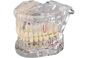 Realistic Dental Implant Model for Educational Purposes