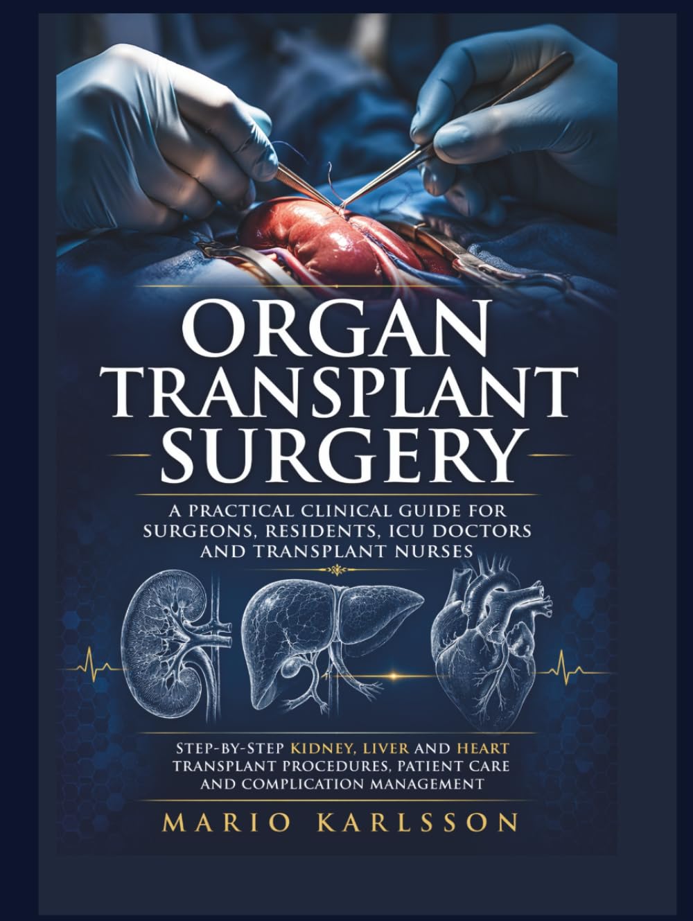 ORGAN TRANSPLANT SURGERY: A Practical Clinical Guide for Surgeons, Residents, ICU Doctors and Transplant Nurses, Step-by-Step Kidney, Liver and Heart Transplant Procedures, Patient Care and Complicati