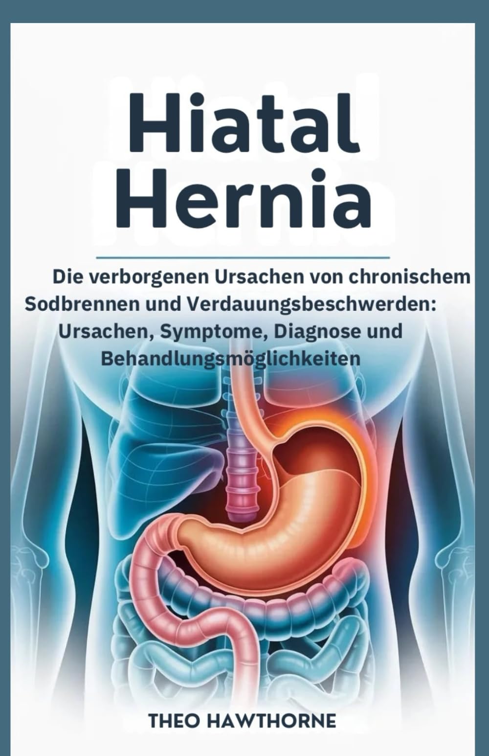 Hiatal Hernia: Die verborgenen Ursachen von chronischem Sodbrennen und Verdauungsbeschwerden: Ursachen, Symptome, Diagnose und Behandlungsmöglichkeiten