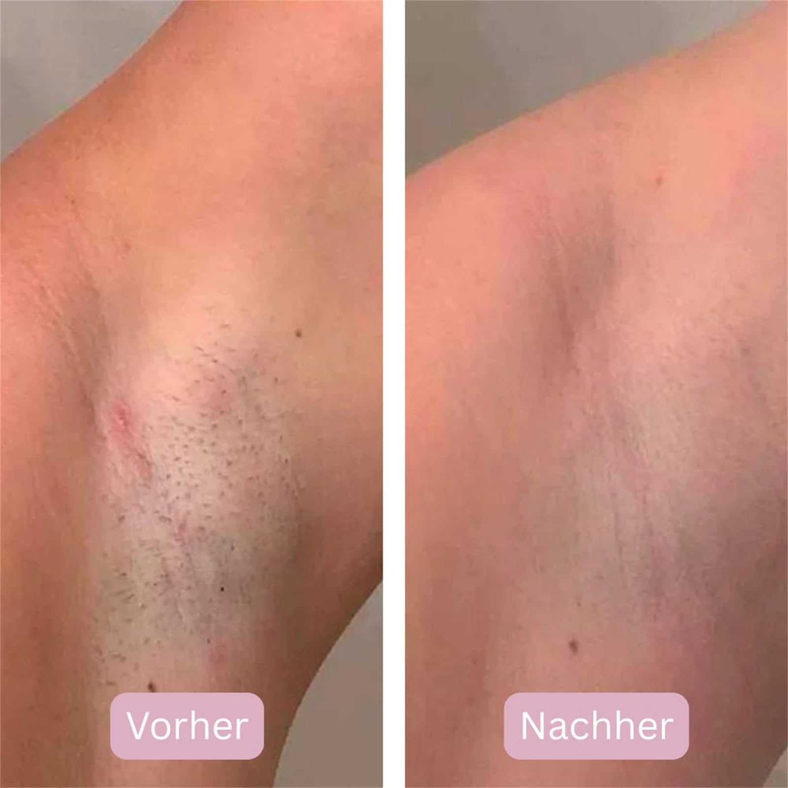 luxderm SilkEase Pro Epilierer Kabelloser 3-in-1 Elektrischer Epilierer für Frauen, wiederaufladbar, IPX7 wasserdicht, LED Display, für trockene und nasse Anwendung geeignet
