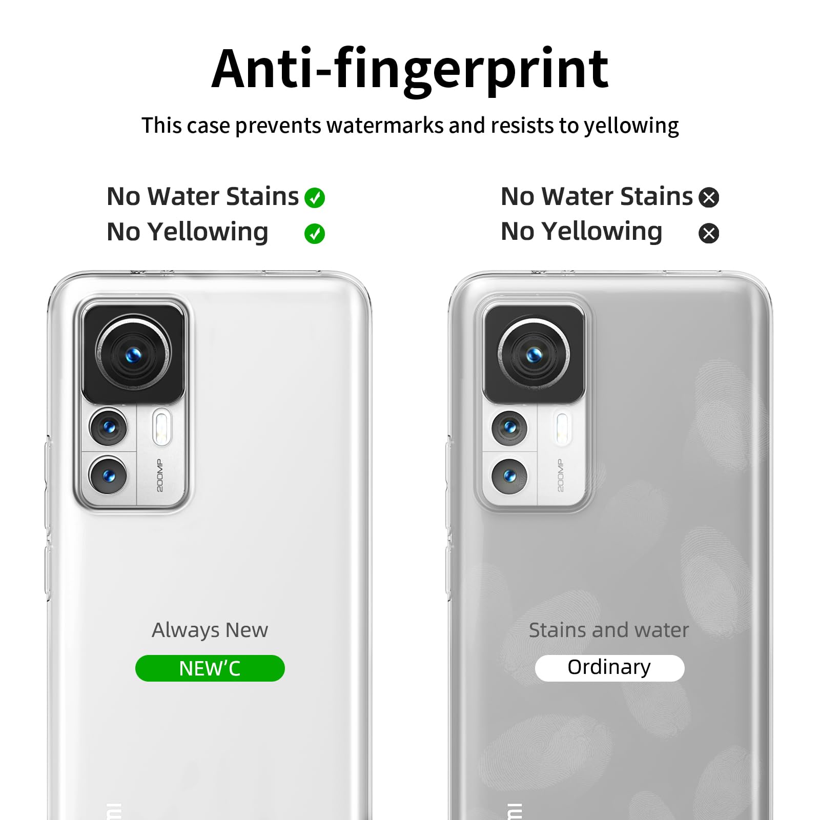 Schutzhülle + 2x Panzerglas Für Xiaomi Redmi Note 12 Pro 5G – Transparent, Stoßfest, Mit Vollem Zugriff