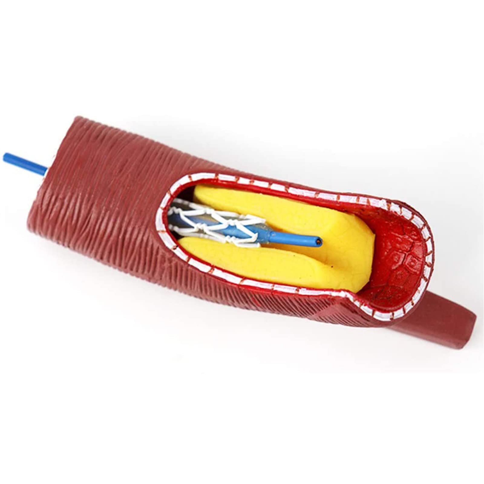 Modello di Blocco dei vasi sanguigni del Cuore e del Cervello Umano, Modello anatomico dello Stent del Corpo Umano per la dimostrazione di Modelli di Anatomia scientifica