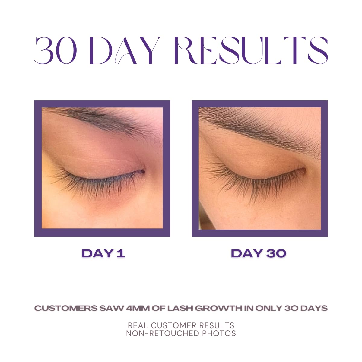 NOONLASH Nourishing Lash Growth Serum - Fuller & Longer Natural Eyelashes, Easy & Quick To Apply, Thin Consistency & Dries Quickly, Non-Harmful Ingredients