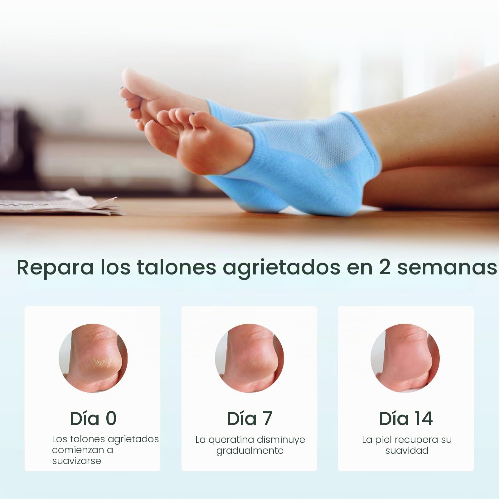Calcetines hidratantes para el tratamiento de talones agrietados - Promifun 2 pares de calcetines hidratantes para pies secos y agrietados - Reparación de talones agrietados - Calcetines para mujeres