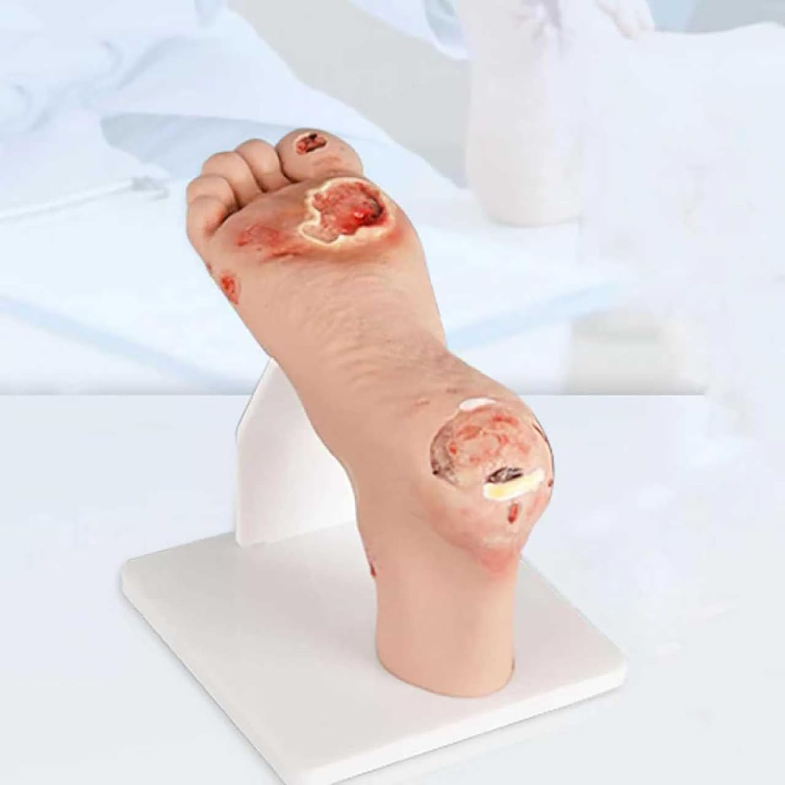 GNbow Human Diabetic foot Pathology Model with 1-3 Mild or 4-5 Severe Purulent Wound Lesions, Realistic Pathological Tool, Diabetic Foot Model for Nursing Teaching, Anatomy