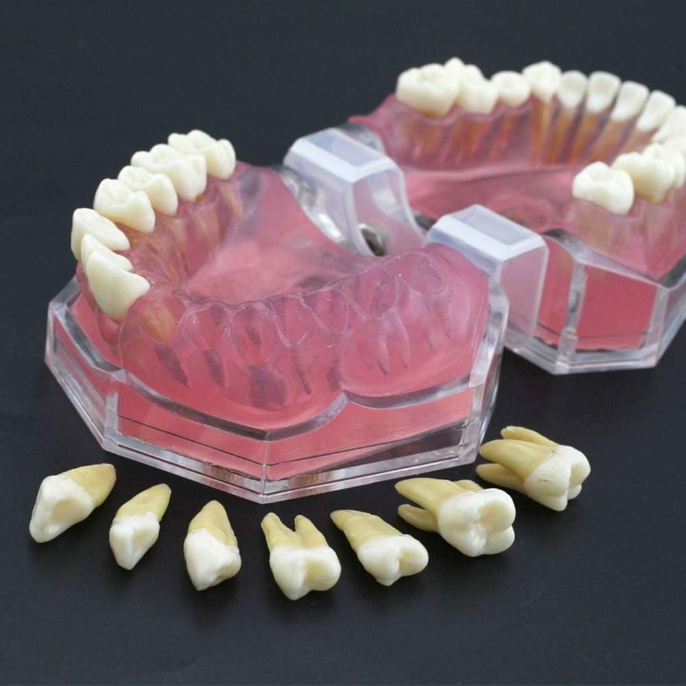 Completa Dental Modelo con los Dientes 28pcs extraíbles y Suave de Las encías estándar para la Enfermedad Tipodonto Estudio Enseñanza de la Ciencia Médica Dental