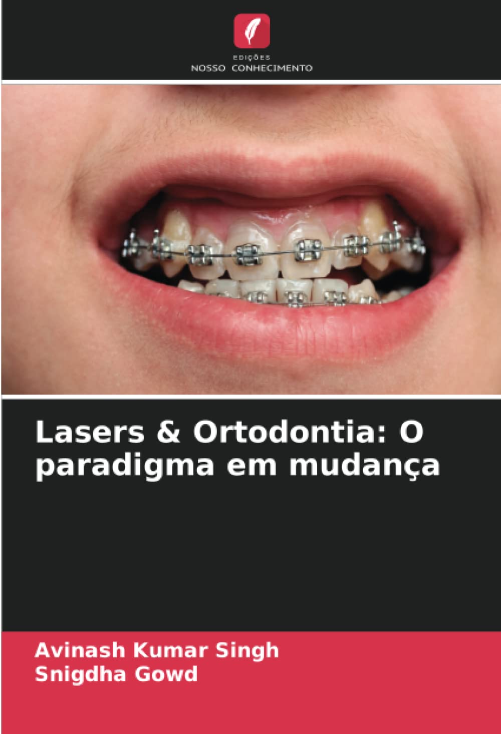 Lasers & Ortodontia: O paradigma em mudança
