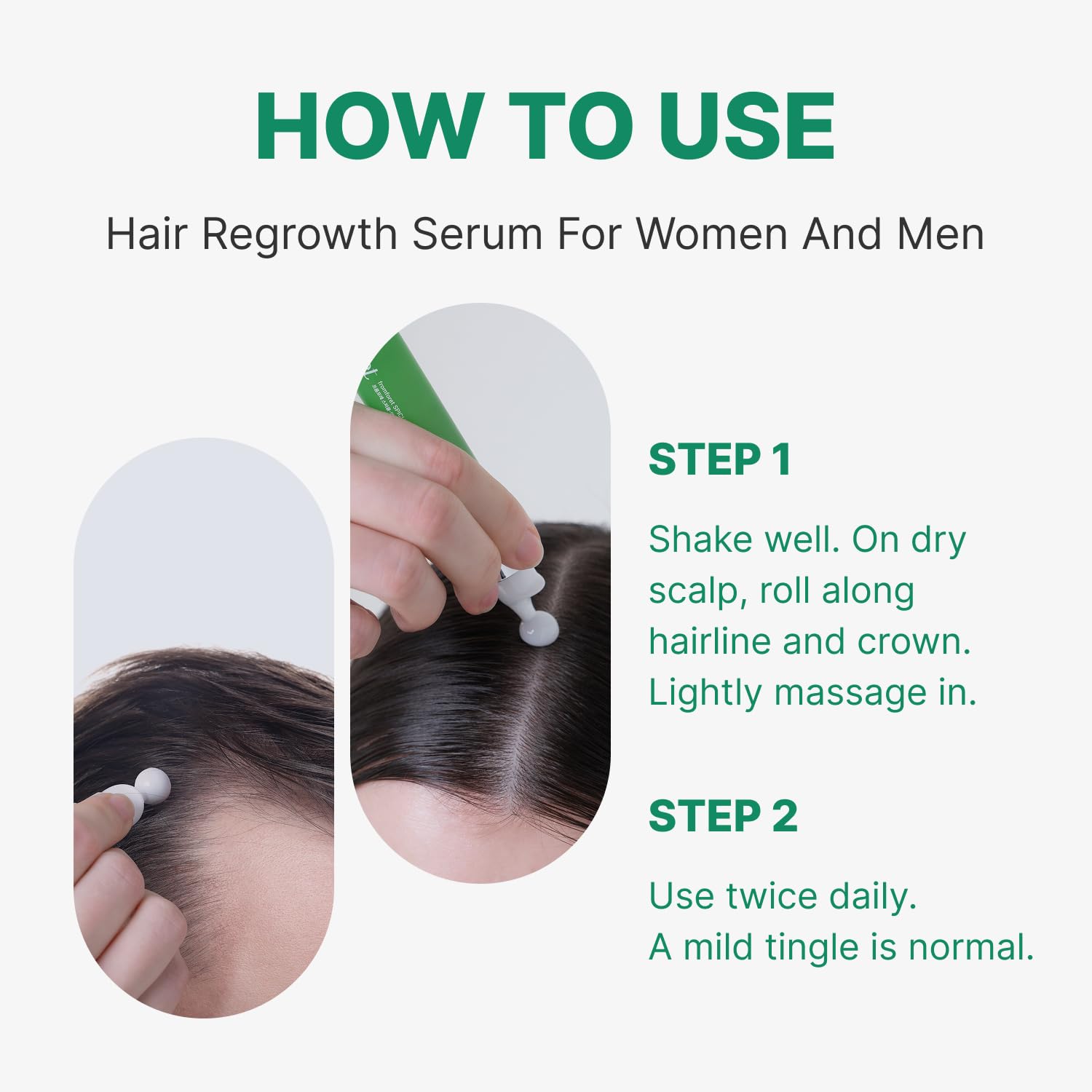 Spicule Microneedling Exosome Hair Growth Serum, Hair Loss Treatments for Women and Men, Peppermint Oil Cooling Scalp Serum, Menthol, Korean Hair Care (0.5 fl oz / 15ml) - Image 6