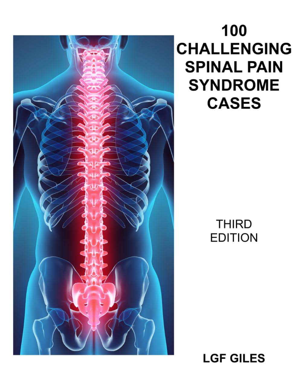 100 Challenging Spinal Pain Syndrome Cases