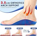 ZONALIYA Orthotic Arch Support Shoe Insoles Pu Cushioning Inserts Shock Absorption Velvet Surfaces Deep Heel Cup Inner Sole for Flat Feet Feet Heel Pain Relief (EU 33-35 Kids) gallery image