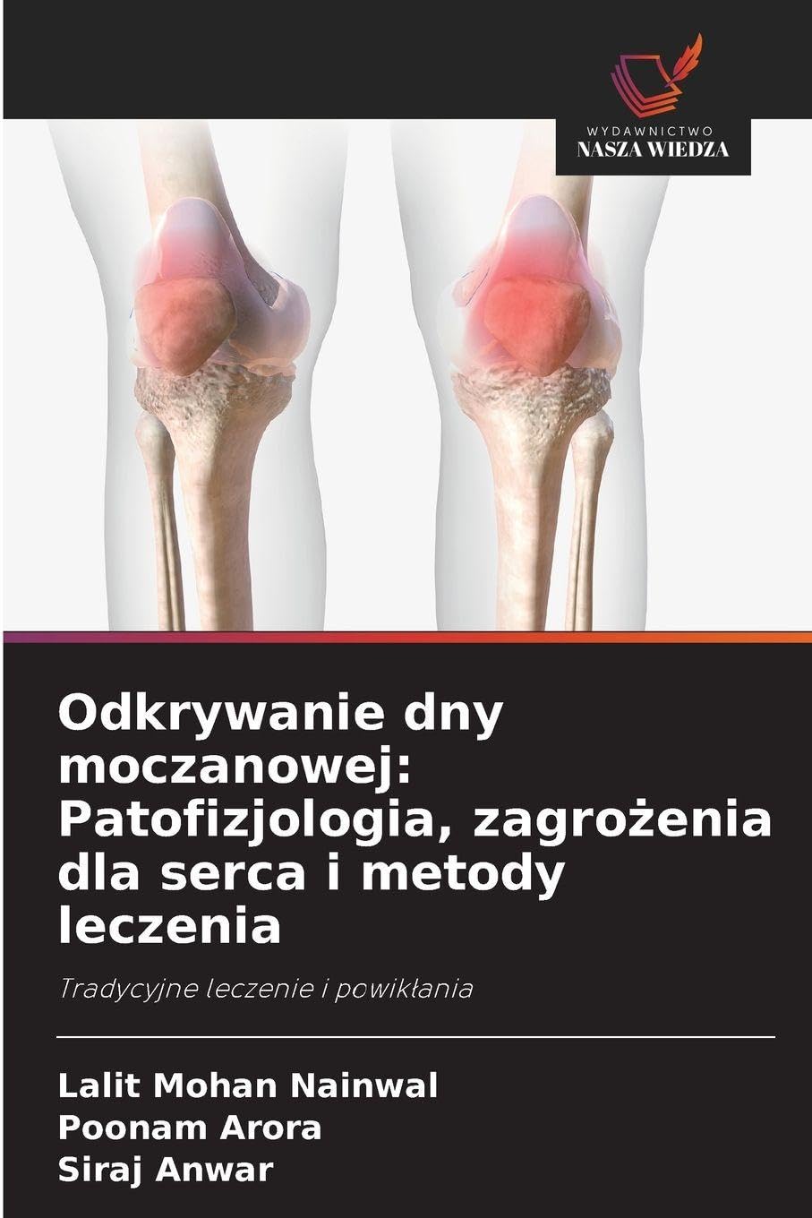Odkrywanie dny moczanowej: Patofizjologia, zagrożenia dla serca i metody leczenia