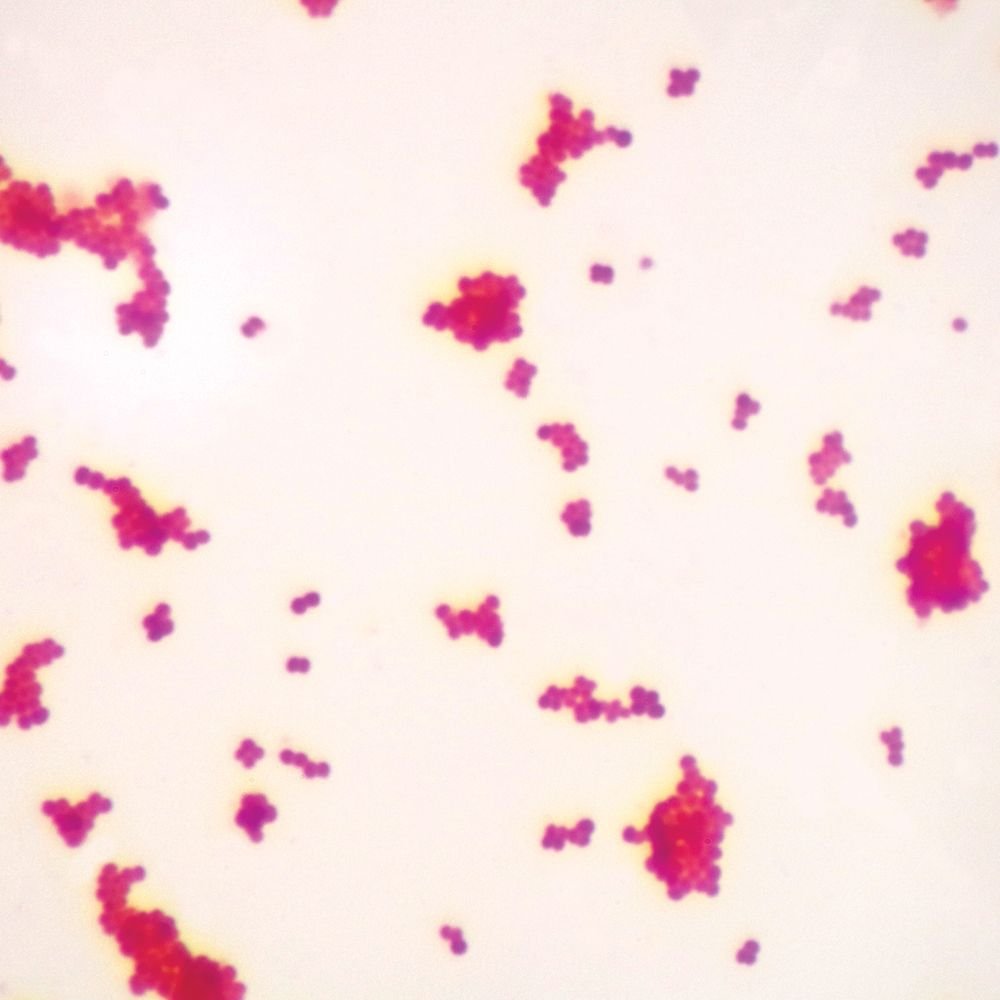 GramNegative Coccus, w.m. Gram Stain Microscope Slide