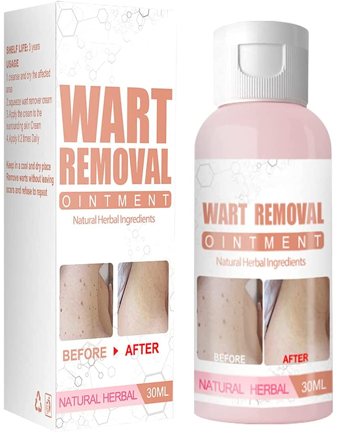Wart Skin Removal Ointment,Skin Tag Removal,Instant Blemish Gel,Easy Application