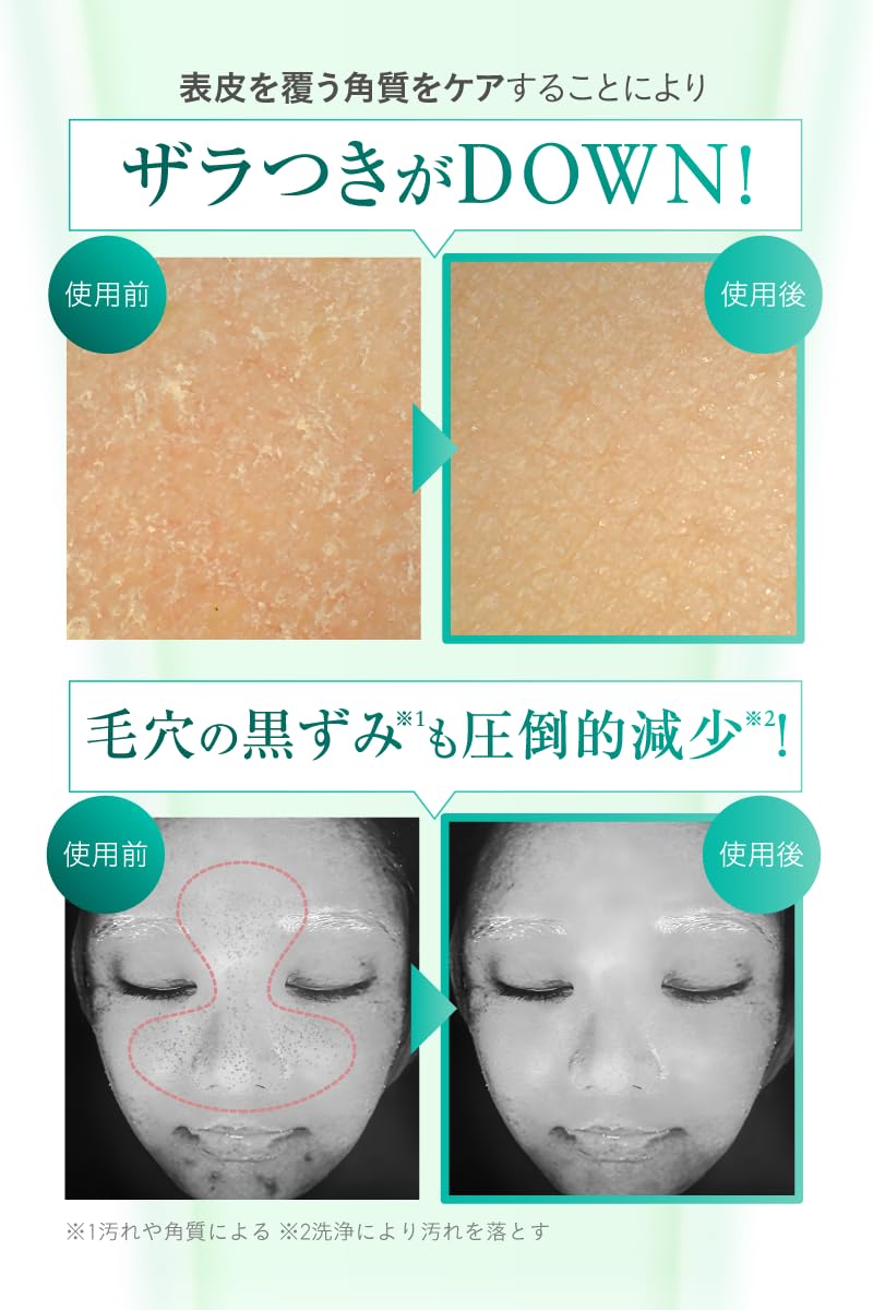 Yomite on:myskin フェイス用 マイクロニードル 角質ケア