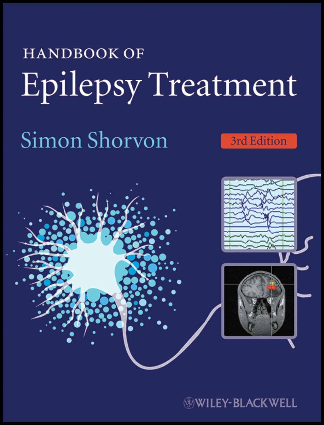 Handbook of Epilepsy Treatment, 3rd Edition