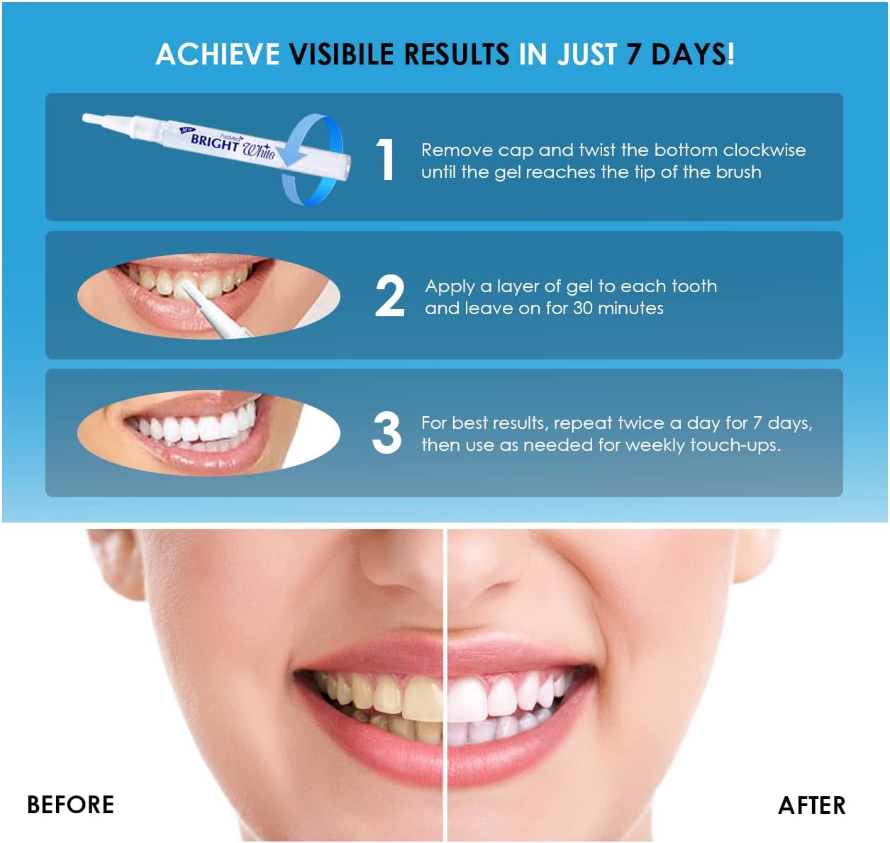 Teeth Whitening Pen (2 Pens), 35% Carbamide Peroxide, Fast Result, Painless and Effective, No Sensitivity, Travel Friendly, Confident White Smile, Natural Mint Flavor (White) : Everything Else