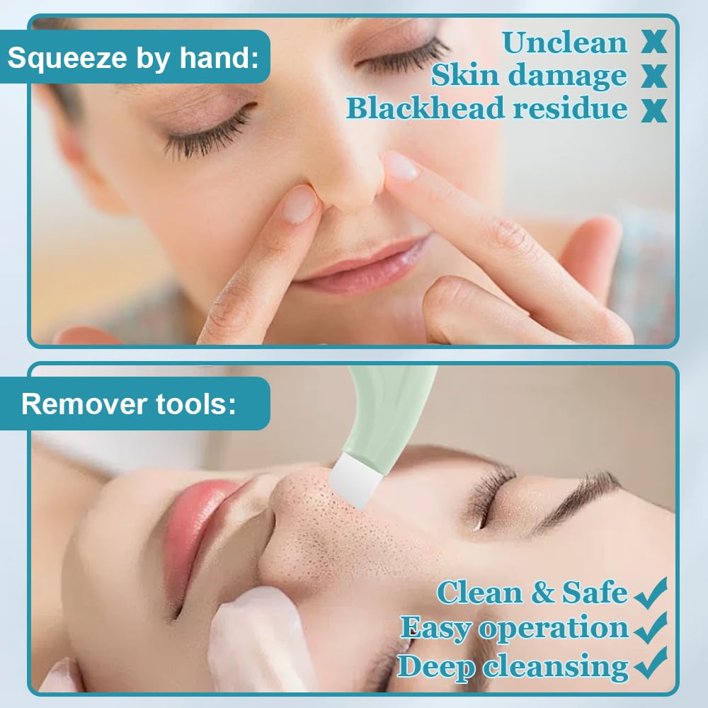 2PCS Nose Blackhead Remover Tool Portable Blackhead Scraper Deep Clean Skin Pore Spatula Face Clean Master for Women Men Black Head Shovel Facial Cleansing Tool - Image 4