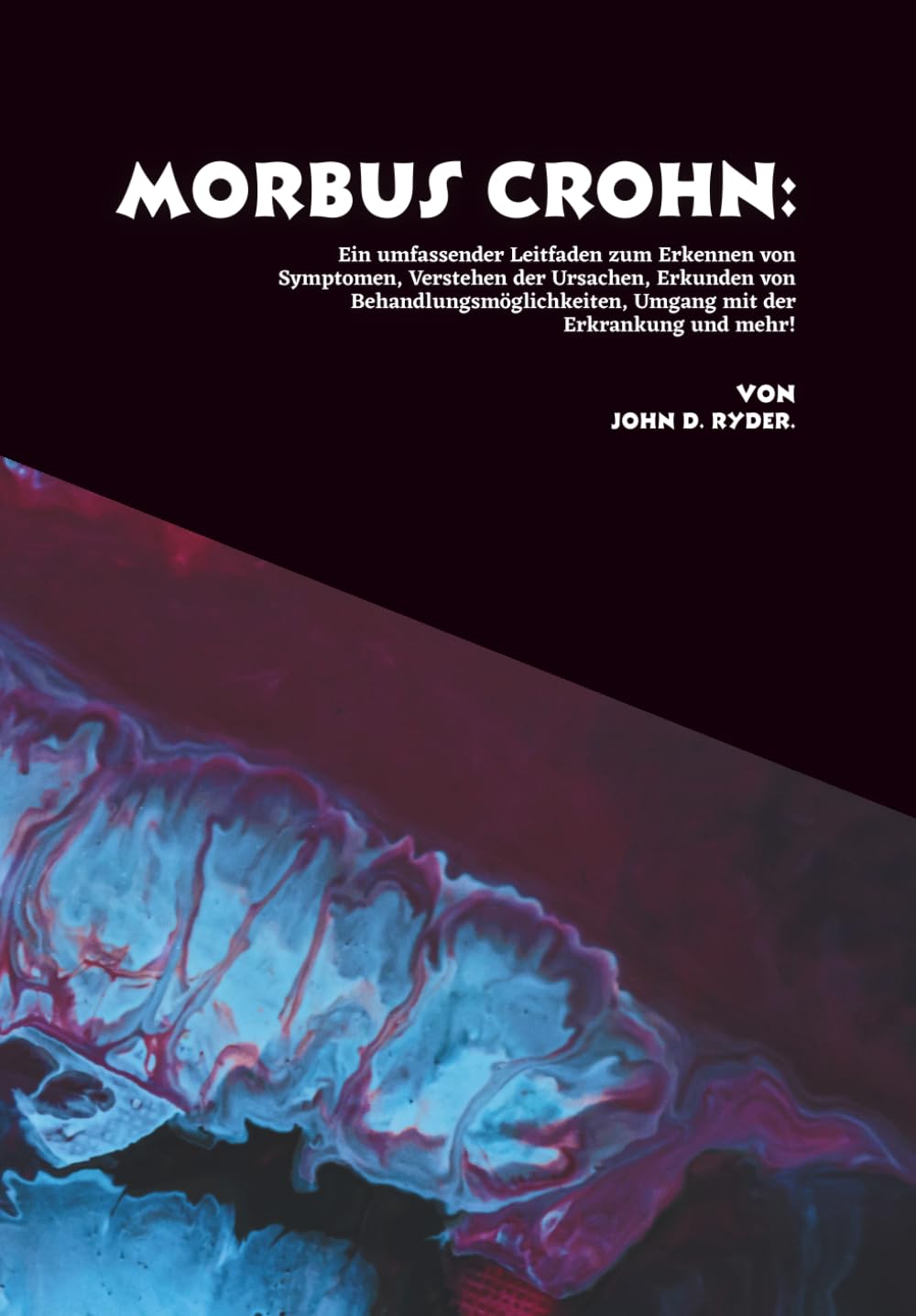 Morbus Crohn: Ein umfassender Leitfaden zum Erkennen von Symptomen, Verstehen der Ursachen, Erkunden von Behandlungsmöglichkeiten, Umgang mit der Erkrankung und mehr!