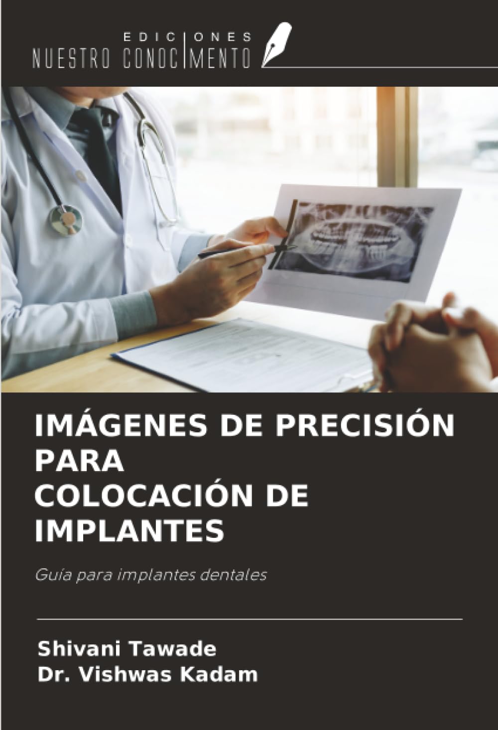 IMÁGENES DE PRECISIÓN PARA COLOCACIÓN DE IMPLANTES: Guía para implantes dentales