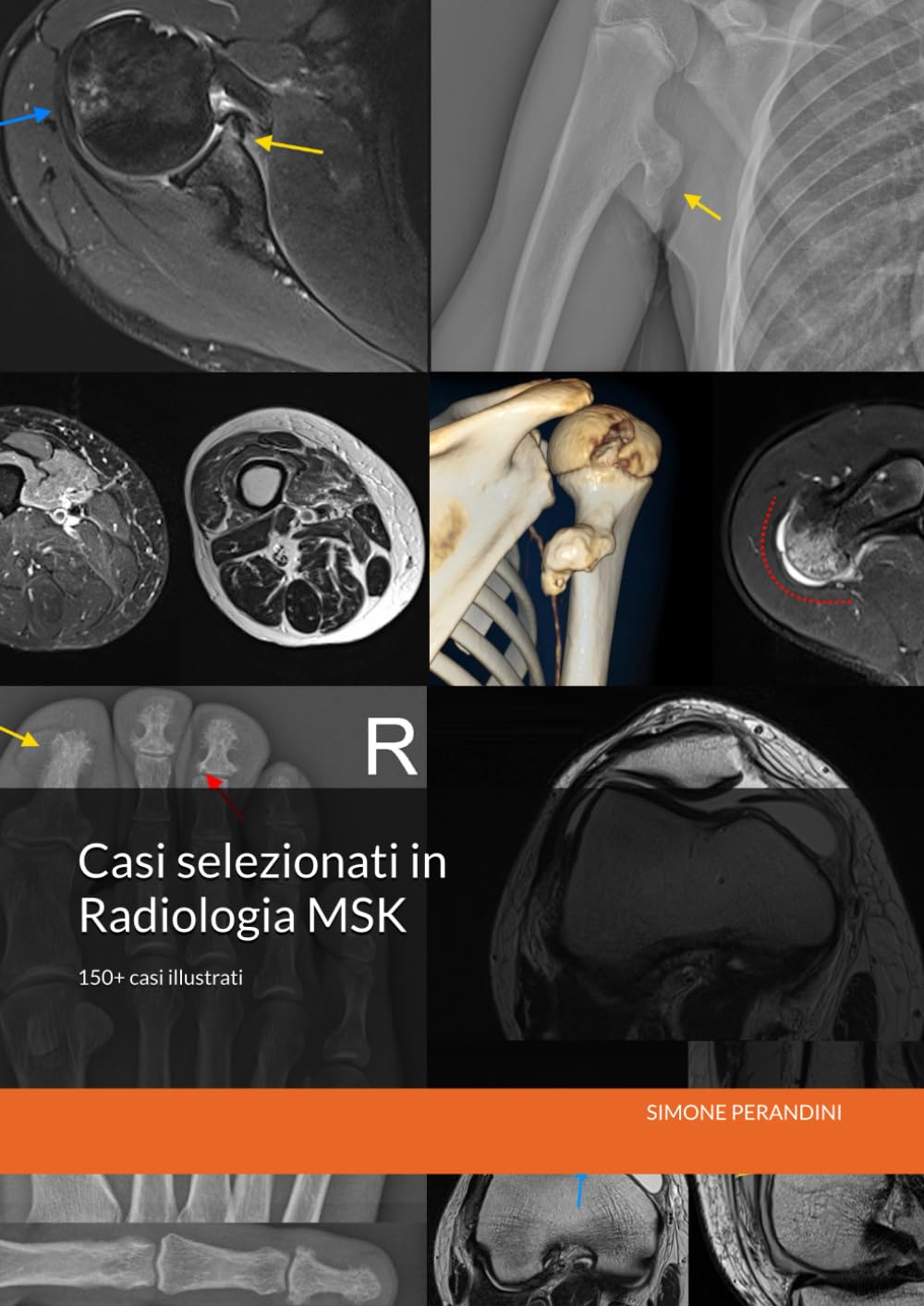 Casi selezionati in Radiologia MSK: Content Driven Learning