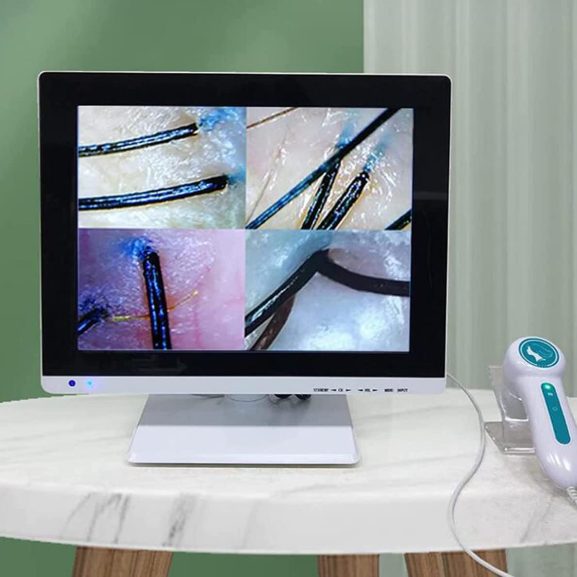 Analizzatore pelle e capelli, schermo 15 pollici, ingrandimento 50x 200x, ABS, fotocamera HD con modalità a tre luci, strumento diagnostico cuoio capelluto e pelle per test follicoli piliferi