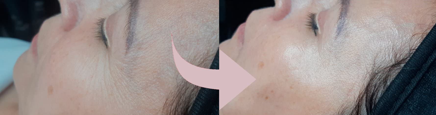 Casmara, krem do twarzy Infinity 50 ml - natychmiastowy efekt liftingu, odmładza dojrzałą skórę i zwalcza głębokie zmarszczki