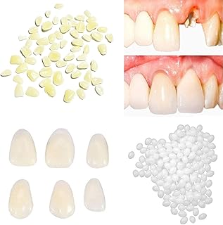 Tooth Repair Kit-Thermal Fitting Beads Granules and Fake Teeth for Temporary Fixing Missing and Broken Tooth，Replace a Missing Tooth in Minutes for Women and Man (Natural Yellow)