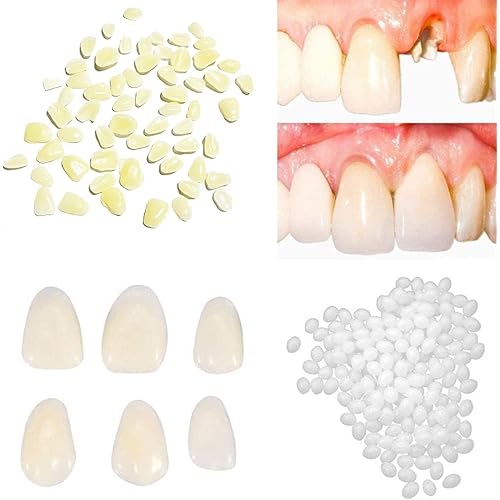 Tooth Repair Kit-Thermal Fitting Beads Granules and Fake Teeth for Temporary Fixing Missing and Broken Tooth，Replace a Missing Tooth in Minutes for Women and Man (Natural Yellow)