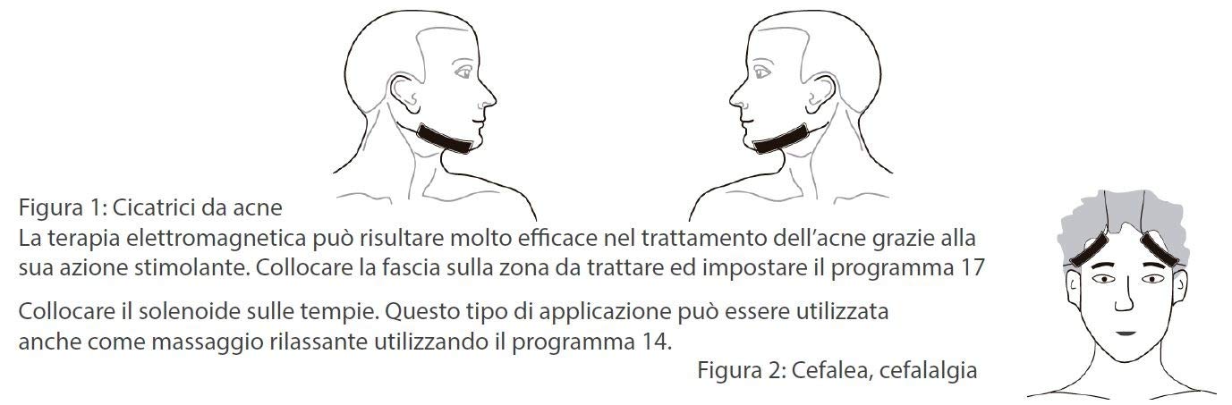 Magnetoterapia con bandas de solenoide CEM MAF para terapia analgésica