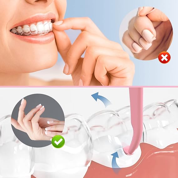 ARGOMAX - Aligner Removal Tool, 2 Retainer Remover Tool, Invisible Braces Removal Tools, Suitable for Removing Braces, Trays, Retainers, Dentures and Aligners(Blue+Pink).