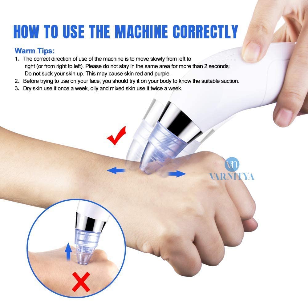 Vyoma Beautiful Skin Care Expert Acne Pore Cleaner Vacuum Blackhead Remover Kit Skin Cleaner, Pimple Removal Tool, Acne Removal Tool, Click N' Play Girl's Pretend (Blue Darma) (A1) 4
