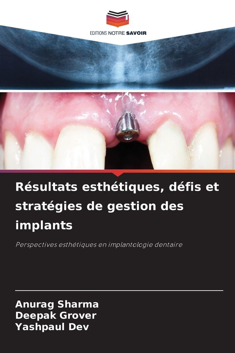 Résultats esthétiques, défis et stratégies de gestion des implants: Perspectives esthétiques en implantologie dentaire