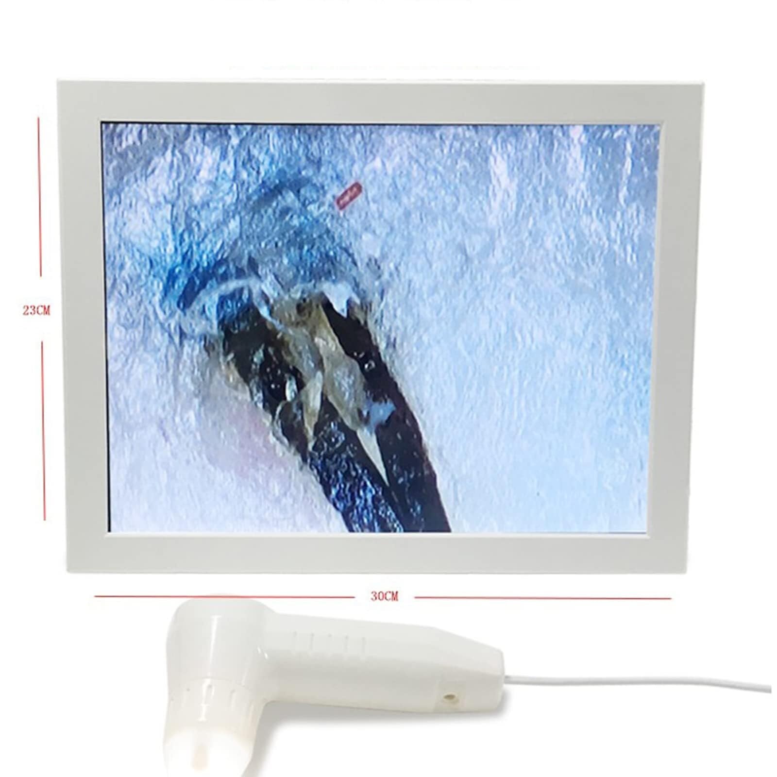 Analizator włosów skóry, 50X 200X detektor włosów skóry głowy, 12-calowy analizator skóry, detektor mieszków włosowych, instrument do pielęgnacji skóry