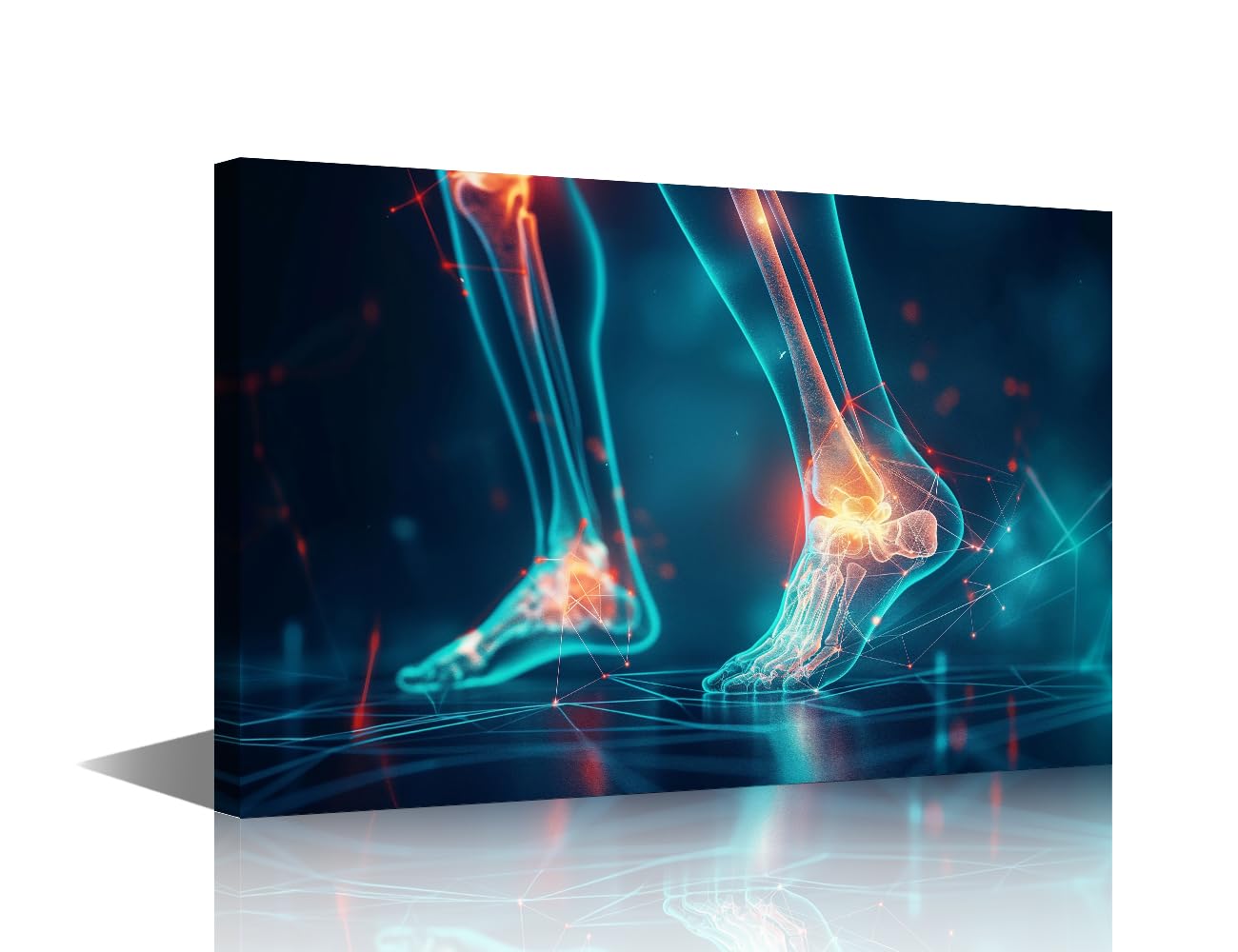 TISHIRON 1 Panel Framed Canvas Wall Art Foot and Leg Pain Injury Pictures Printing Poster Leg Pain Canvas Prints Wall Decor for Doctor's Office X-ray Room Decor Ready to Hang 12" Wx 18" H