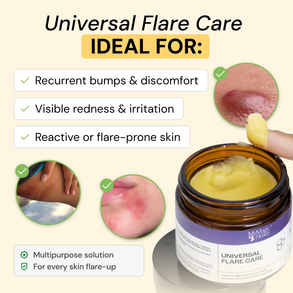 MyMagicHealer Universal Flare Care - Pomada extractora para HS, forúnculos, quistes, hemorroides, quiste pilonidal, absceso, antirozaduras, cuidado de heridas, alivio para el picor de piel con