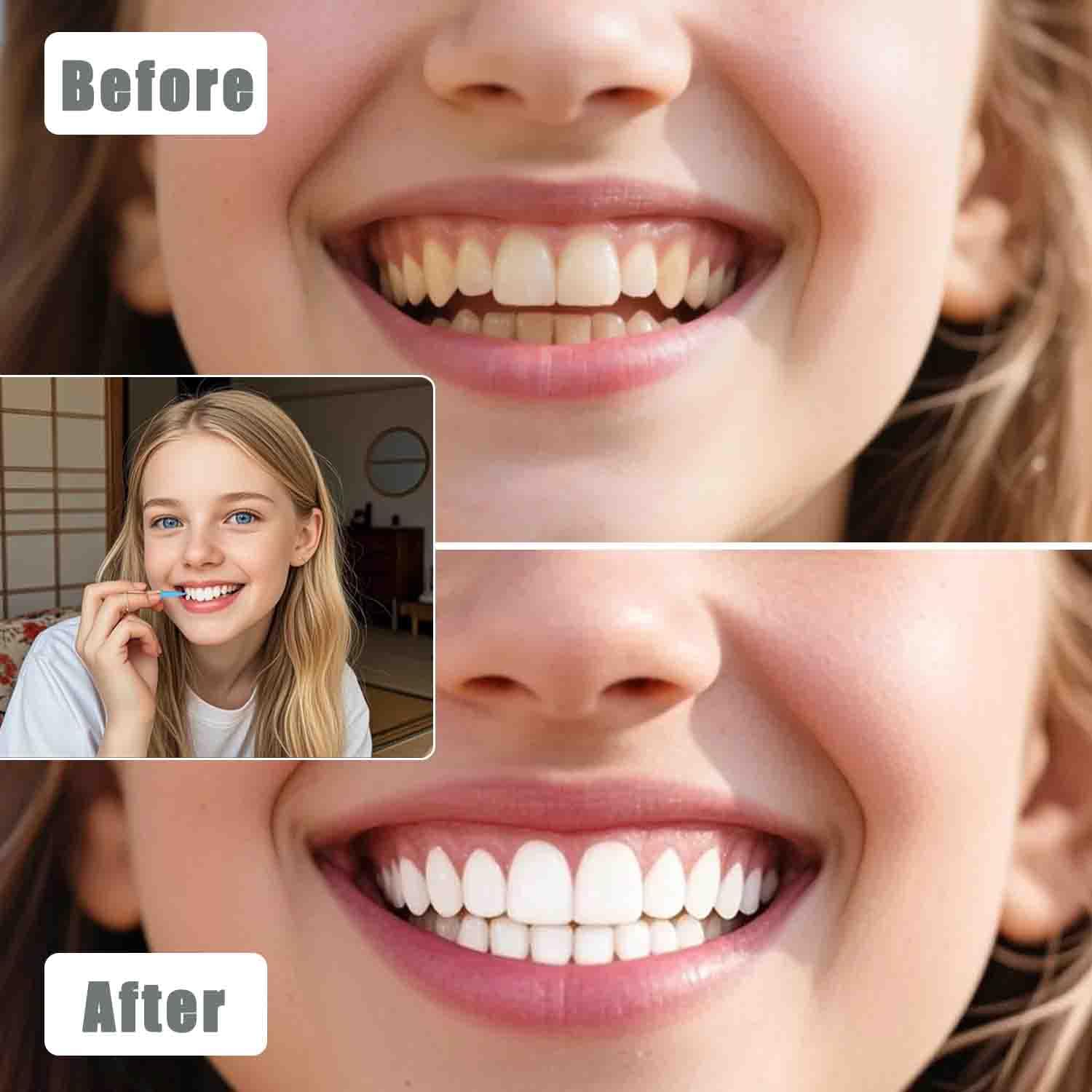 100 cepillos interdentales, herramientas de limpieza dental, palillos de dientes para higiene bucal