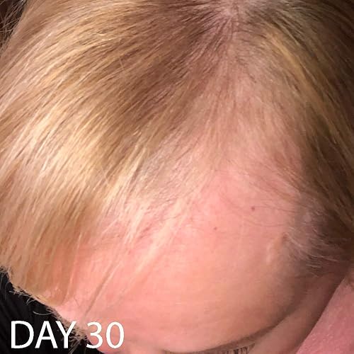 Miniatura 5 de Acondicionador de crecimiento del cabello de la vitamina de la biotina-(alta potencia) acondicionador de biotina para el crecimiento más rápido del