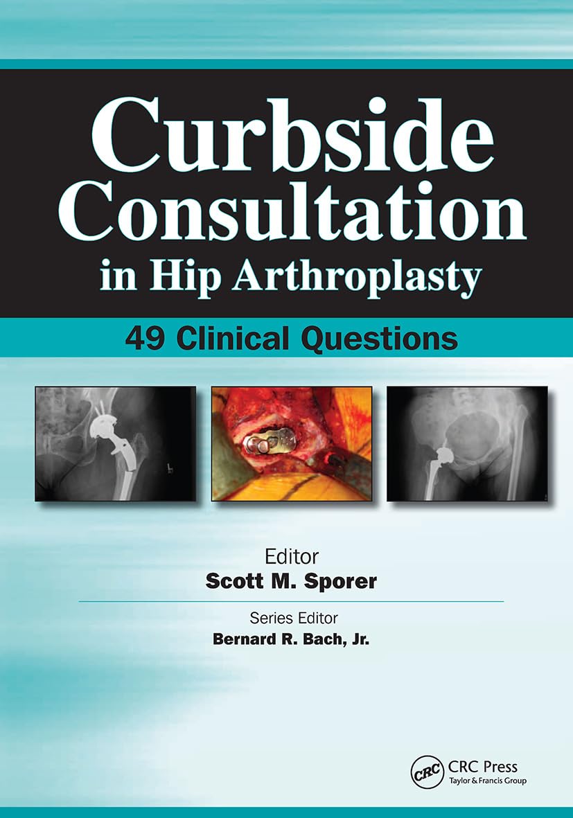 Buy Curbside Consultation in Hip Arthroplasty: 49 Clinical Questions (Curbside Consultation in Orthopedics) — BookShops.in