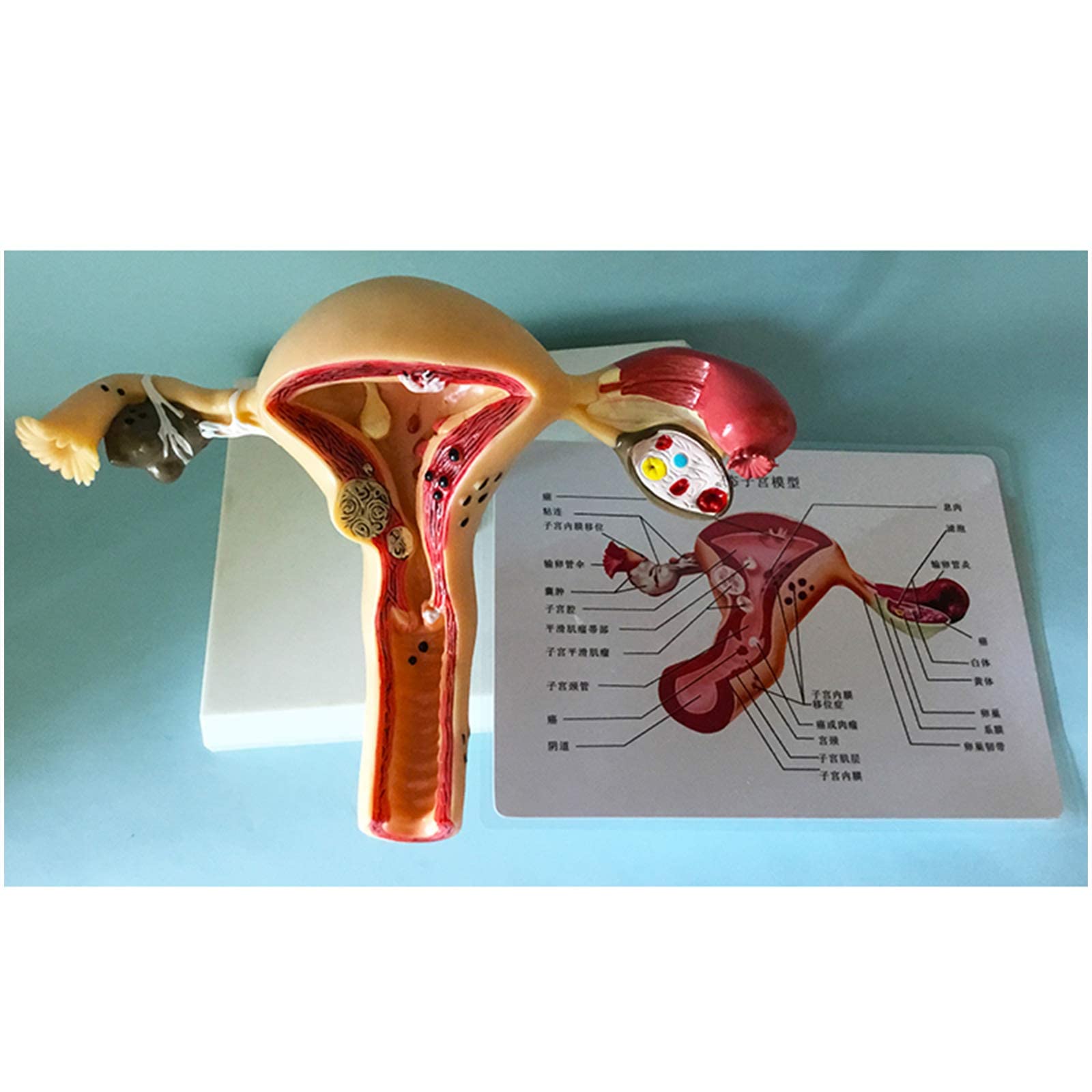 子宫 Amazon.co.jp: 病理学的子宮モデル-子宮と卵巣モデル-女性生殖器系医師のオフィス教育ツールのための人体解剖学レプリカ : 産業・研究開発用品