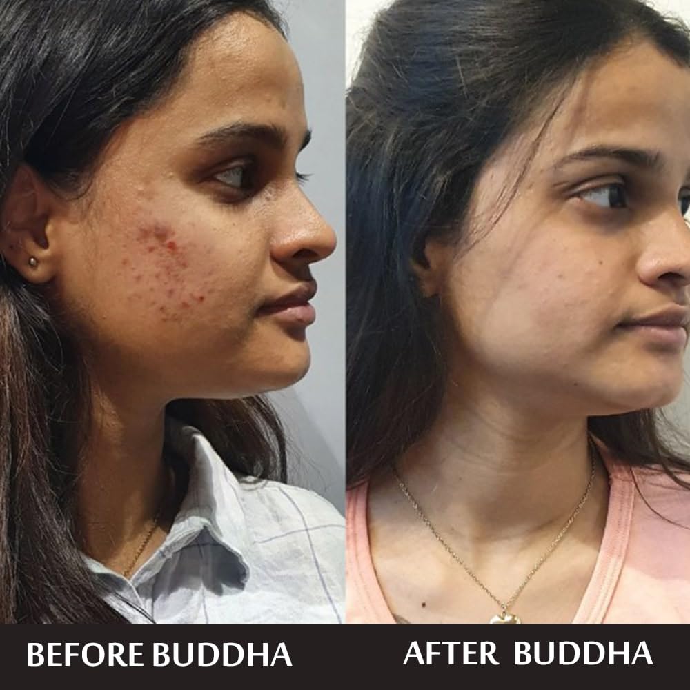 Buddha Natural Anti Acne Face Wash - Combat Acne, Nourish, Hydrate And Promote Clear Skin | Ideal For Oily Skin - Anti Acne Face Wash For Oily Skin