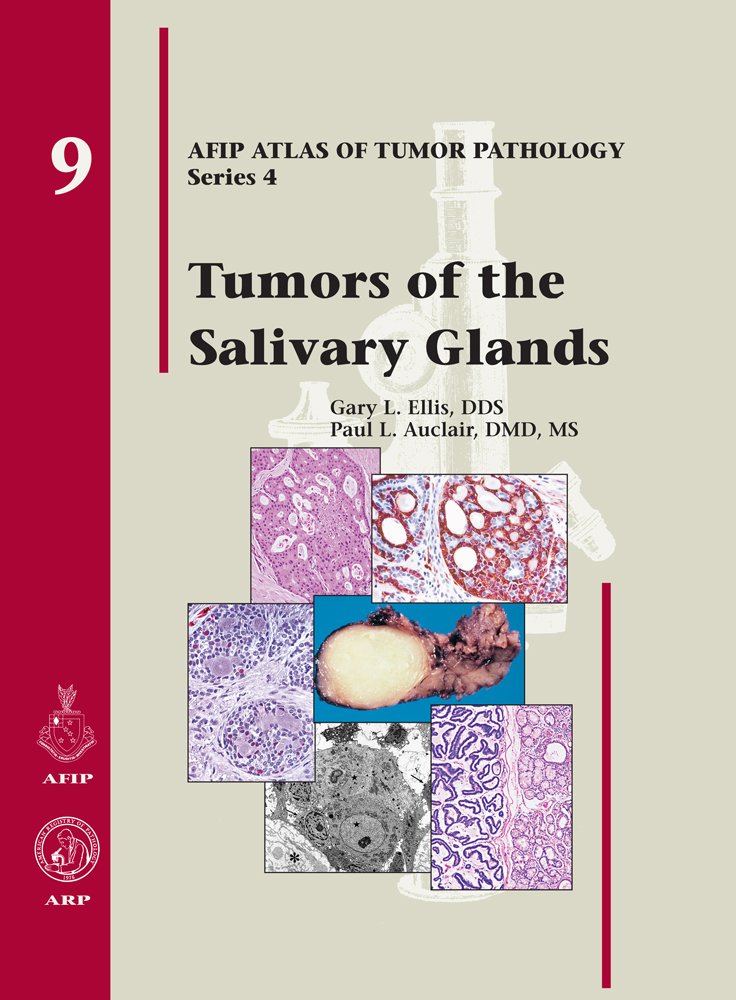 Tumors of the Salivary Glands (Afip Atlas of Tumor Pathology) Ellis，Gary L.; Auclair，Paul L. Tumors of the Salivary Glands: Ellis, Gary L., Auclair, Paul L