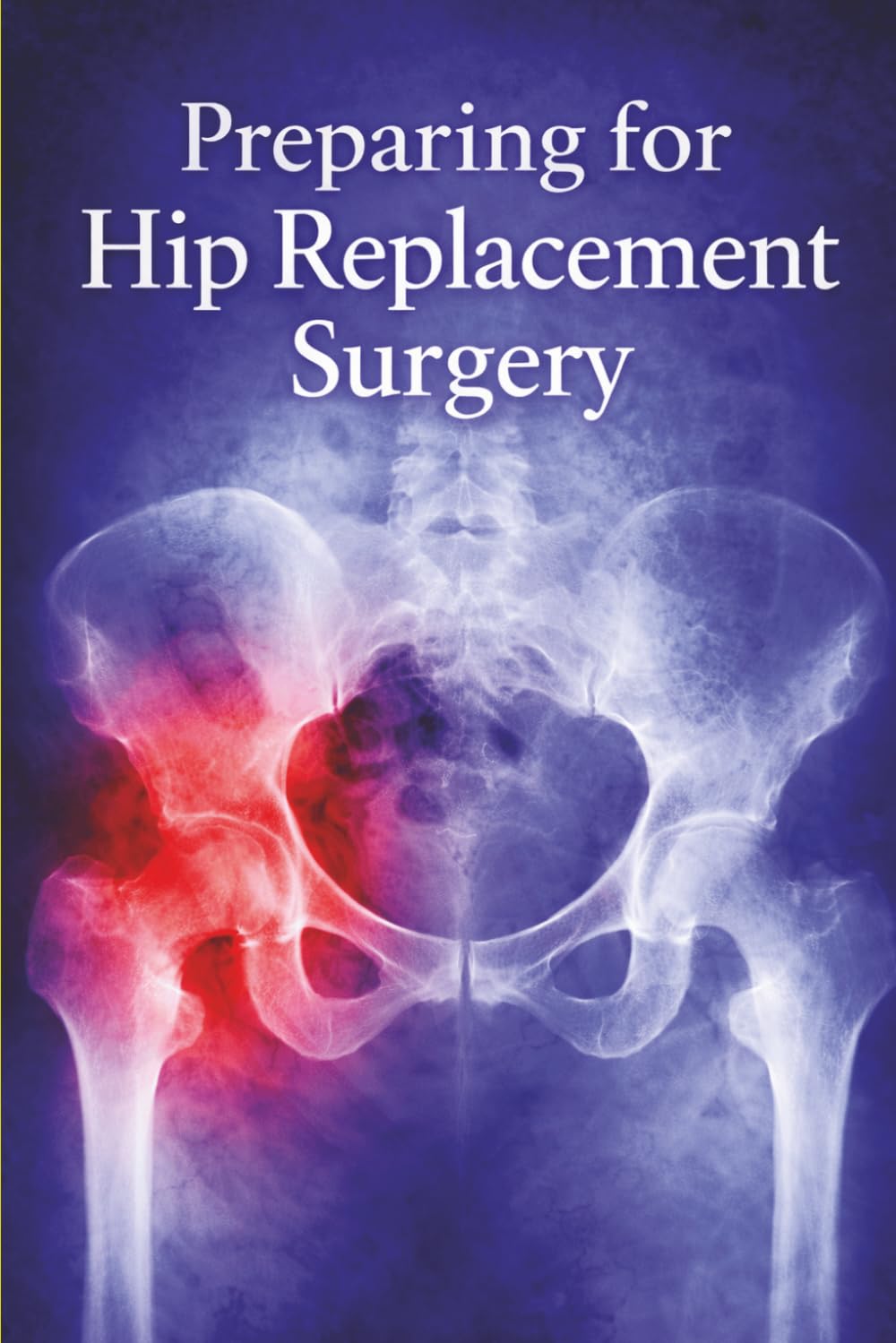 Preparing for Hip Replacement Surgery: Guidance for hip surgery