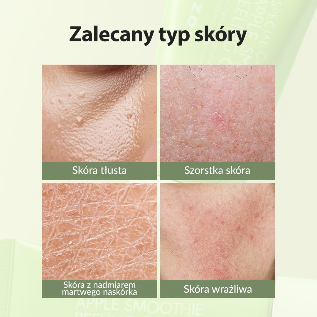 [MIZON] APPLE SMOOTHIE PEELING GEL (120 ml) koreańska pielęgnacja skóry, żel złuszczający z ekstraktem z jabłka, zmiękcza i ujędrnia, korekcja odcienia skóry, nawilżenie, kontrola sebum