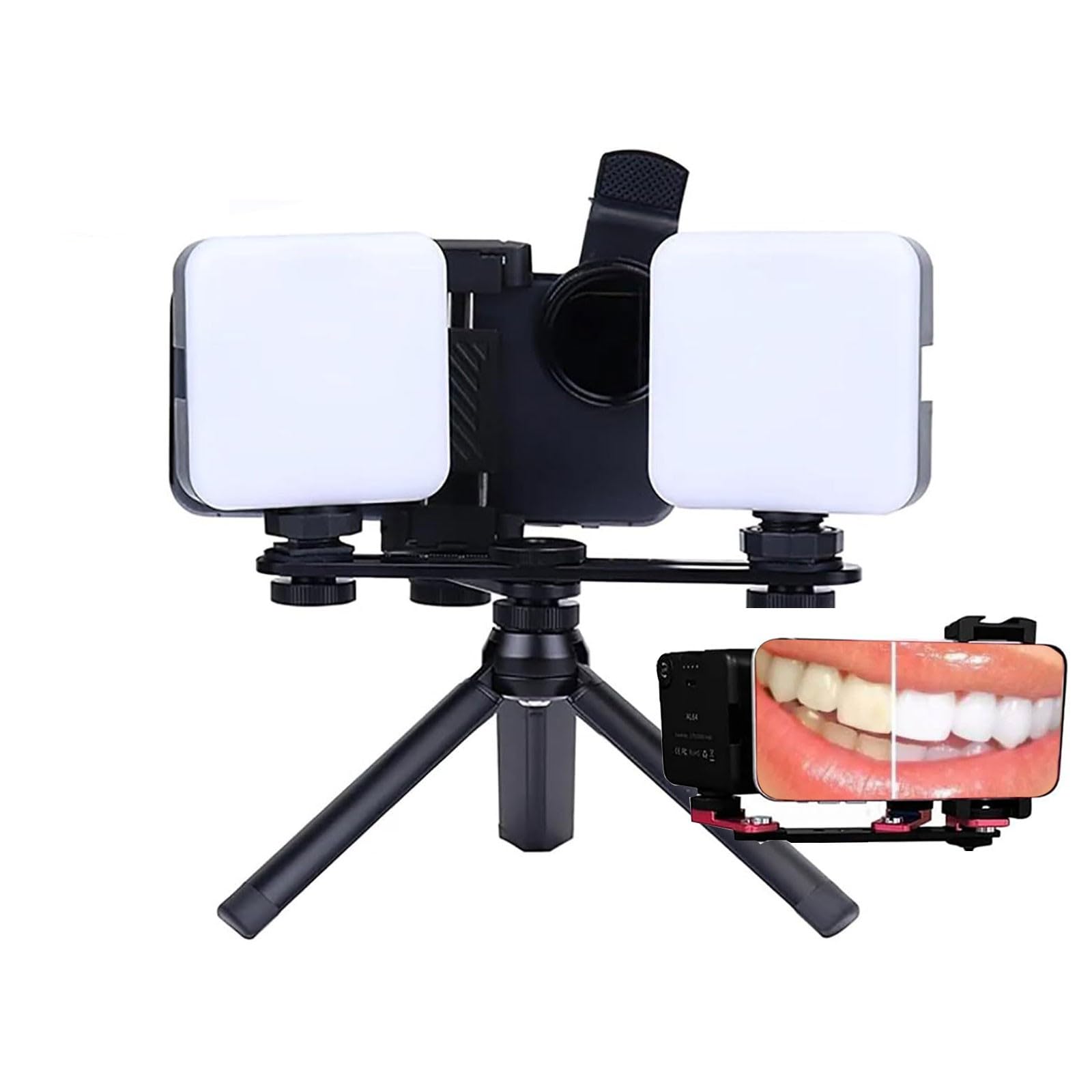 Kit de fotografía dental con luz LED para cámara de teléfono móvil, luz de relleno, flash dental brillante para odontología, clínica doméstica, hospital y estudio.(MKT-017)