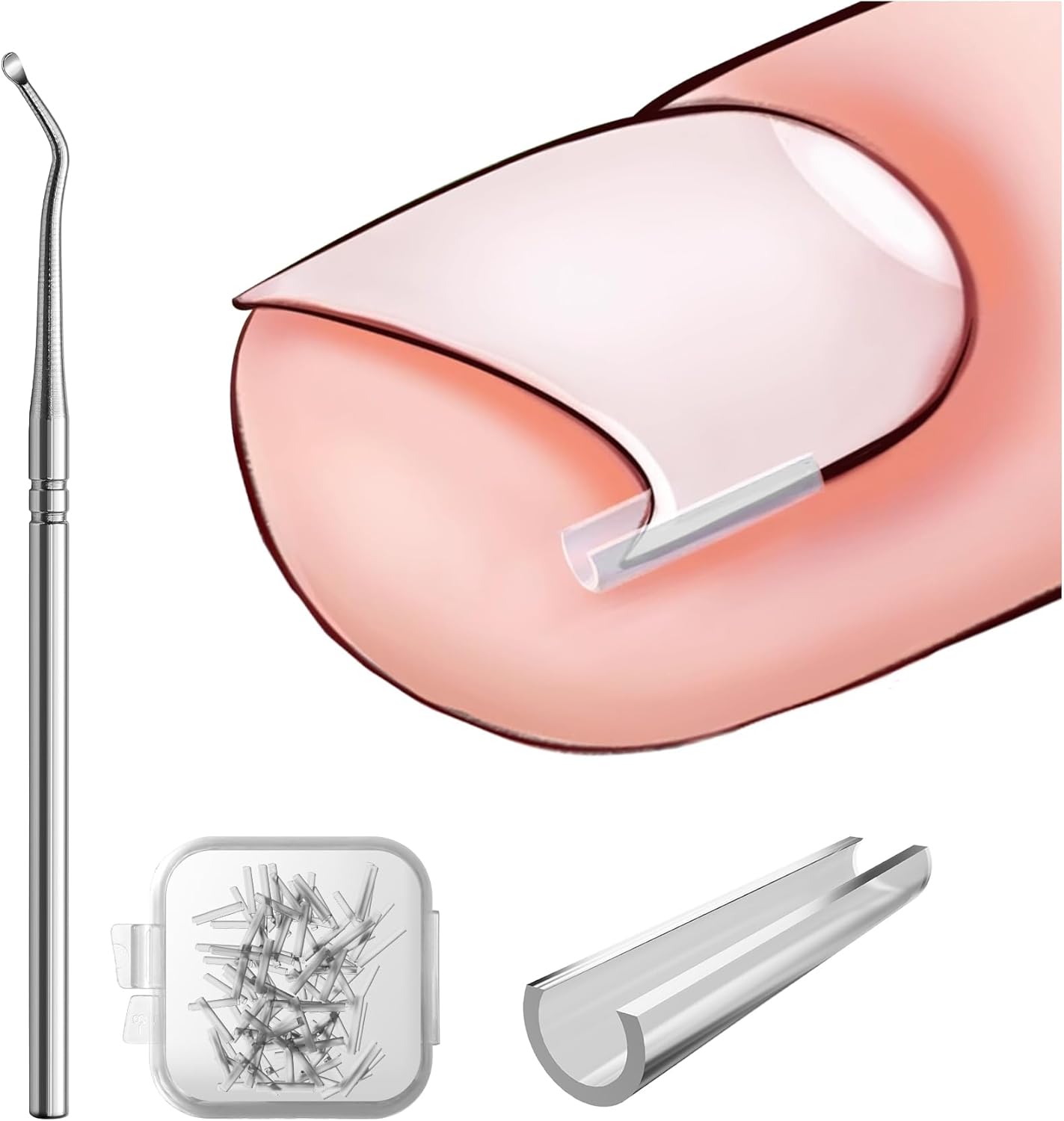 BEZOX Ingrown Toenail Corrector Set 40 Pcs PainFree Toenail